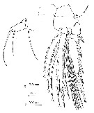Espce Oncaea mediterranea - Planche 14 de figures morphologiques