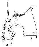 Espce Paraeuchaeta sarsi - Planche 11 de figures morphologiques