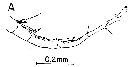 Espce Labidocera carpentariensis - Planche 7 de figures morphologiques