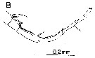 Espce Labidocera moretoni - Planche 7 de figures morphologiques
