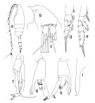 Espce Paraeuchaeta grandiremis - Planche 2 de figures morphologiques