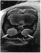 Espce Candacia simplex - Planche 12 de figures morphologiques
