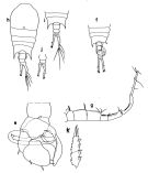 Espce Temora discaudata - Planche 1 de figures morphologiques