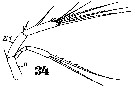Espce Microsetella norvegica - Planche 11 de figures morphologiques