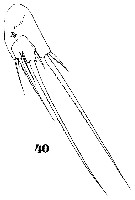 Espce Microsetella norvegica - Planche 9 de figures morphologiques