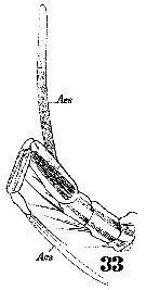 Espce Microsetella norvegica - Planche 13 de figures morphologiques