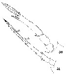 Espce Oncaea ornata - Planche 10 de figures morphologiques