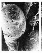 Espce Clytemnestra gracilis - Planche 17 de figures morphologiques