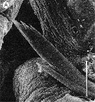 Espce Clytemnestra gracilis - Planche 18 de figures morphologiques