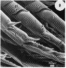 Espce Temora longicornis - Planche 8 de figures morphologiques