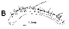 Espce Cosmocalanus darwini - Planche 15 de figures morphologiques