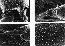 Espce Aetideopsis rhinoceros - Planche 7 de figures morphologiques
