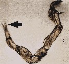 Espce Labidocera bengalensis - Planche 3 de figures morphologiques