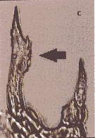 Espce Tortanus (Tortanus) barbatus - Planche 5 de figures morphologiques