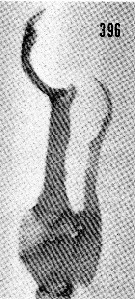 Espce Scottocalanus helenae - Planche 19 de figures morphologiques