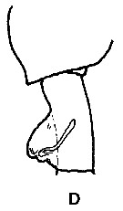 Espce Paraeuchaeta tonsa - Planche 23 de figures morphologiques