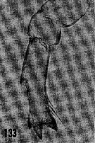 Espce Candacia pachydactyla - Planche 13 de figures morphologiques