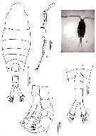 Espce Centropages tenuiremis - Planche 10 de figures morphologiques