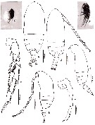 Espce Acrocalanus gibber - Planche 9 de figures morphologiques