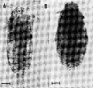 Espce Paracalanus parvus - Planche 34 de figures morphologiques