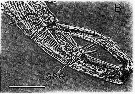 Espce Centropages typicus - Planche 21 de figures morphologiques