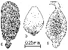 Espce Calanus hyperboreus - Planche 16 de figures morphologiques