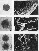 Espce Paracartia latisetosa - Planche 9 de figures morphologiques