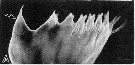 Espce Centropages abdominalis - Planche 8 de figures morphologiques