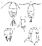 Espce Metacalanus acutioperculum - Planche 4 de figures morphologiques