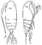 Espce Euchirella rostromagna - Planche 14 de figures morphologiques