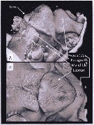 Espce Metridia lucens - Planche 24 de figures morphologiques