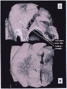 Espce Neocalanus cristatus - Planche 14 de figures morphologiques