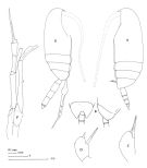 Espce Scolecithricella minor - Planche 2 de figures morphologiques