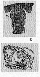Espce Eurytemora affinis - Planche 9 de figures morphologiques