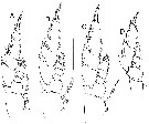 Espce Bathycalanus tumidus - Planche 4 de figures morphologiques