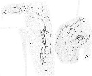 Espce Candacia bradyi - Planche 9 de figures morphologiques