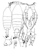 Espce Centropages sinensis - Planche 2 de figures morphologiques