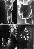 Espce Heterorhabdus spinifrons - Planche 8 de figures morphologiques