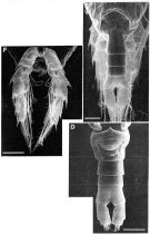 Espce Calanoides patagoniensis - Planche 2 de figures morphologiques