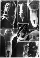 Espce Aetideus arcuatus - Planche 5 de figures morphologiques