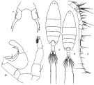 Espce Labidocera euchaeta - Planche 1 de figures morphologiques