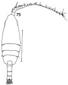 Espce Undeuchaeta plumosa - Planche 6 de figures morphologiques