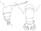 Espce Scottocalanus helenae - Planche 7 de figures morphologiques
