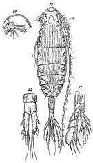 Espce Augaptilus anceps - Planche 2 de figures morphologiques
