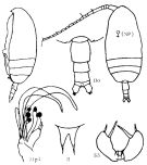 Espce Scolecithricella globulosa - Planche 3 de figures morphologiques