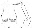 Espce Parvocalanus serratipes - Planche 2 de figures morphologiques