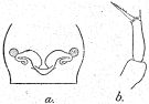 Espce Parvocalanus dubia - Planche 2 de figures morphologiques