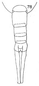 Espce Lucicutia wolfendeni - Planche 7 de figures morphologiques