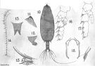 Espce Scottocalanus setosus - Planche 2 de figures morphologiques