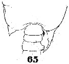 Espce Pontellopsis strenua - Planche 5 de figures morphologiques